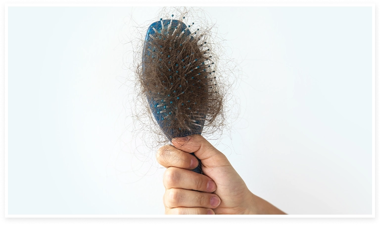 peine lleno de cabellos causado por un tipo de alopecia