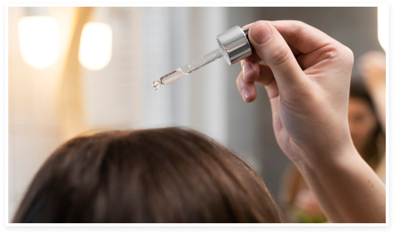Persona colocándose minoxidil en el cuero cabelludo