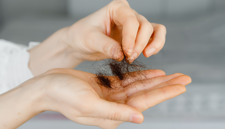 caída del pelo excesiva