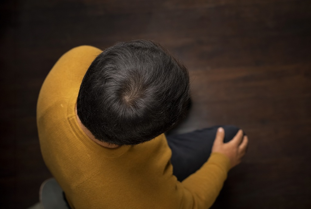 Cómo saber si tengo alopecia